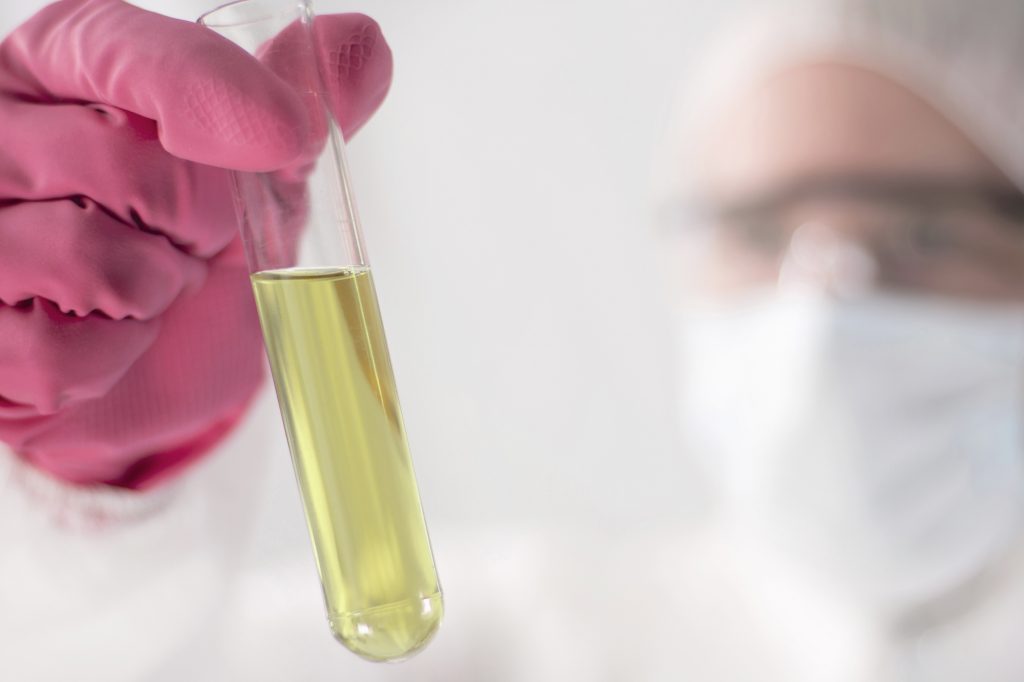 Ketone Testing